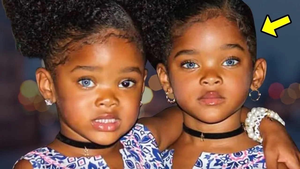 Remember The Most Beautiful Black Twins in The World This is What Happened to Them!